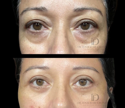 Slider image (8) Dr. Ignacio De Las Fuentes